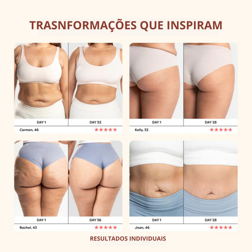 DrenaRoller Massageador Linfático para Lipedema e Celulite